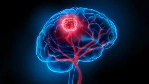 brain-cancer-tumor-blood-vessels.webp.webp