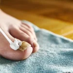 The rotten egg smell that could finally beat nail fungus